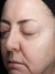 Image of face before using product